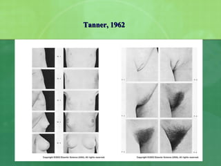 Tanner, 1962
 