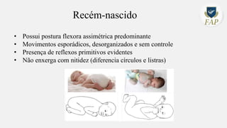 Recém-nascido
• Possui postura flexora assimétrica predominante
• Movimentos esporádicos, desorganizados e sem controle
• Presença de reflexos primitivos evidentes
• Não enxerga com nitidez (diferencia círculos e listras)
 
