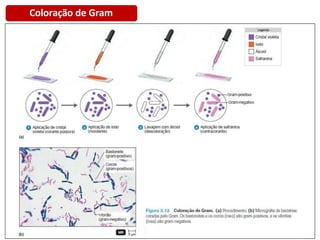 Coloração de Gram
 