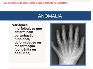 Uso obrigatorio de jaleco, calça e sapato fechado no laboratório
ANOMALIA
Variações
morfológicas que
determinam
perturbação
funcional,
deformidades ou
má formação
(congênita ou
adquirida).
 