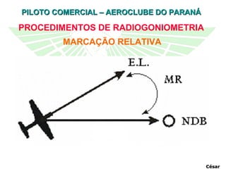 MARCAÇÃO RELATIVA PROCEDIMENTOS DE RADIOGONIOMETRIA César 