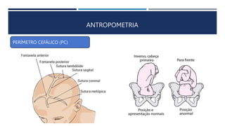 PERÍMETRO CEFÁLICO (PC)
ANTROPOMETRIA
 
