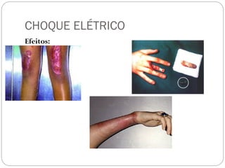 CHOQUE ELÉTRICO
Efeitos:
.
.
 