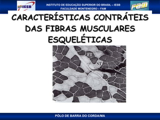 CARACTERÍSTICAS CONTRÁTEIS DAS FIBRAS MUSCULARES ESQUELÉTICAS PÓLO DE BARRA DO CORDA/MA 