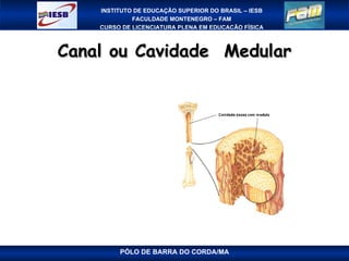 Canal ou Cavidade  Medular PÓLO DE BARRA DO CORDA/MA 