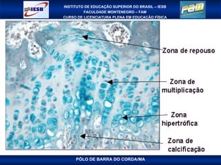 PÓLO DE BARRA DO CORDA/MA 