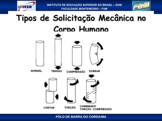 Tipos de Solicitação Mecânica no Corpo Humano PÓLO DE BARRA DO CORDA/MA 