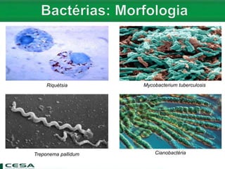 Riquétsia
Cianobactéria
Mycobacterium tuberculosis
Treponema pallidum
 