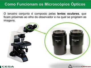 O terceiro conjunto é composto pelas lentes oculares, que
ficam próximas ao olho do observador e na qual se projetam as
imagens.
 