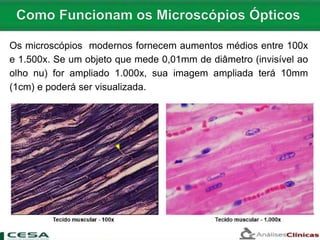 Os microscópios modernos fornecem aumentos médios entre 100x
e 1.500x. Se um objeto que mede 0,01mm de diâmetro (invisível ao
olho nu) for ampliado 1.000x, sua imagem ampliada terá 10mm
(1cm) e poderá ser visualizada.
 