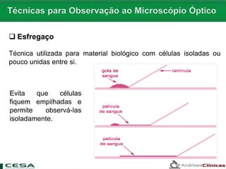  Esfregaço
Técnica utilizada para material biológico com células isoladas ou
pouco unidas entre si.
Evita que células
fiquem empilhadas e
permite observá-las
isoladamente.
 