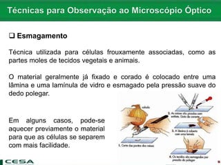  Esmagamento
Técnica utilizada para células frouxamente associadas, como as
partes moles de tecidos vegetais e animais.
O material geralmente já fixado e corado é colocado entre uma
lâmina e uma lamínula de vidro e esmagado pela pressão suave do
dedo polegar.
Em alguns casos, pode-se
aquecer previamente o material
para que as células se separem
com mais facilidade.
 