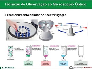  Fracionamento celular por centrifugação
 
