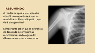 RESUMINDO
A resultante após a interação dos
raios-X com o paciente é que irá
sensibilizar o filme radiográfico, que
dará a imagem final.
É importante saber que as diferenças
de densidade determinam as
características radiológicas dos
diferentes materiais e estruturas.
 