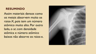 RESUMINDO
Assim materiais densos como
os metais absorvem muito os
raios-X, pois tem um número
atômico muito alto. Por outro
lado, o ar, com densidade
atômica e número atômico
baixos não absorve os raios-x.
 