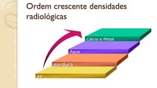 Ordem crescente densidades
radiológicas
Cálcio e Metal
Água
gordura
ar
Add Your Text
Add Your Text
Add Your Text
Add Your Text
 