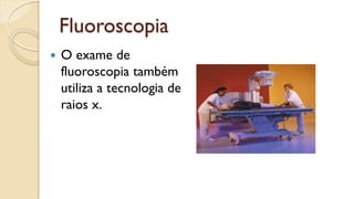Fluoroscopia
 O exame de
fluoroscopia também
utiliza a tecnologia de
raios x.
 