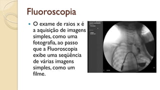Fluoroscopia
 O exame de raios x é
a aquisição de imagens
simples, como uma
fotografia, ao passo
que a Fluoroscopia
exibe uma seqüência
de várias imagens
simples, como um
filme.
 