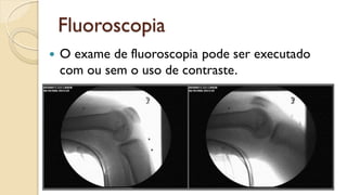 Fluoroscopia
 O exame de fluoroscopia pode ser executado
com ou sem o uso de contraste.
 