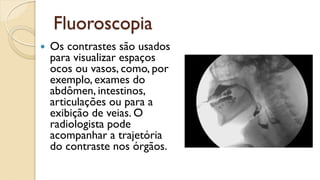 Fluoroscopia
 Os contrastes são usados
para visualizar espaços
ocos ou vasos, como, por
exemplo, exames do
abdômen, intestinos,
articulações ou para a
exibição de veias. O
radiologista pode
acompanhar a trajetória
do contraste nos órgãos.
 