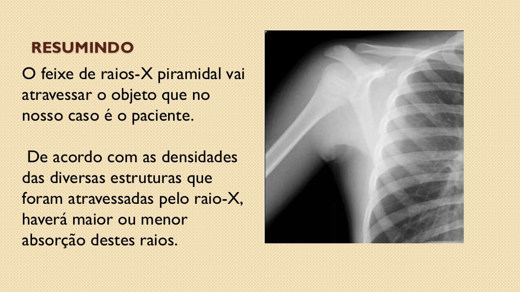 Aula 02 física do raio x e bases de exames