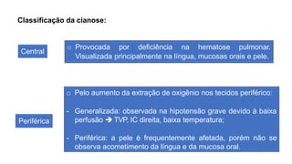 Classificação da cianose:
Central
Periférica
o Provocada por deficiência na hematose pulmonar.
Visualizada principalmente na língua, mucosas orais e pele.
o Pelo aumento da extração de oxigênio nos tecidos periférico:
- Generalizada: observada na hipotensão grave devido à baixa
perfusão  TVP, IC direita, baixa temperatura;
- Periférica: a pele é frequentemente afetada, porém não se
observa acometimento da língua e da mucosa oral.
 