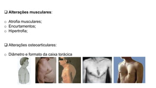  Alterações musculares:
o Atrofia musculares;
o Encurtamentos;
o Hipertrofia;
 Alterações osteoarticulares:
o Diâmetro e formato da caixa torácica
M. Acessória da respiração
Normal Barril Cifótico Escavatum
Carinatum
 