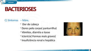BACTERIOSES
C) Sintomas – febre.
- Dor de cabeça
- Dores pelo corpo( panturrilha)
- Vômitos, diarréia e tosse
- Icterícia( Formas mais graves)
- Insuficiência renal e hepática
18
 