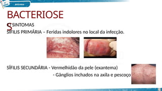 BACTERIOSE
S
C) SINTOMAS
SÍFILIS PRIMÁRIA – Feridas indolores no local da infecção.
SÍFILIS SECUNDÁRIA - Vermelhidão da pele (exantema)
- Gânglios inchados na axila e pescoço.
21
 