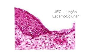 JEC - Junção
EscamoColunar
 