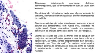 Citoplasma relativamente abundante, delicado,
semitransparente, que cora fracamente em azul, às vezes com
vacúolos.
Os núcleos são redondos ou ovais, com alguma variação do
tamanho, cromatina finamente granular exibindo cromocentros
ou nucléolo.
Quando as células são vistas lateralmente, assumem a forma
colunar alta característica, com núcleo oval, localizado na
região basal. Nessa perspectiva, quando em conjuntos,
constituem os arranjos conhecidos como “fila”, ou “paliçada”.
Quando as células são vistas de frente, elas se agrupam em
conjuntos monoestratificados, perdem a sua forma colunar e
apresentam, às vezes, bordas citoplasmáticas bem definidas,
lembrando um “favo de mel”. Os núcleos arredondados
mostram polaridade conservada (a distância entre os núcleos
é relativamente constante, não ocorrendo sobreposição
nuclear).
 