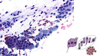 Constituintes Normais do Esfregaço Cervicovaginal