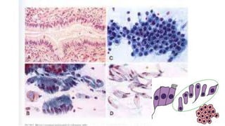 Constituintes Normais do Esfregaço Cervicovaginal