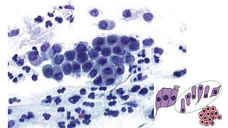 Constituintes Normais do Esfregaço Cervicovaginal