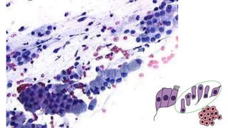 Constituintes Normais do Esfregaço Cervicovaginal