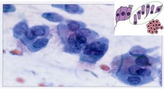 Constituintes Normais do Esfregaço Cervicovaginal