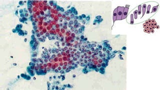 Constituintes Normais do Esfregaço Cervicovaginal