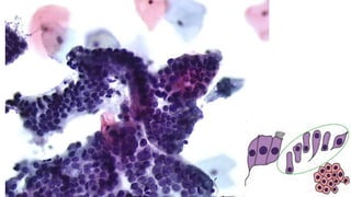 Constituintes Normais do Esfregaço Cervicovaginal