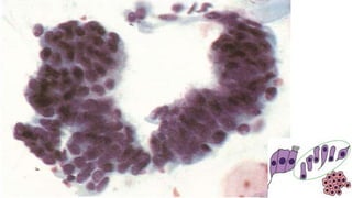 Constituintes Normais do Esfregaço Cervicovaginal