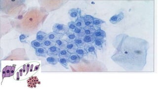 Constituintes Normais do Esfregaço Cervicovaginal