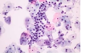 Constituintes Normais do Esfregaço Cervicovaginal