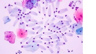 Constituintes Normais do Esfregaço Cervicovaginal