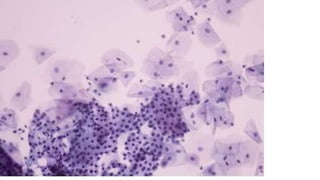 Constituintes Normais do Esfregaço Cervicovaginal