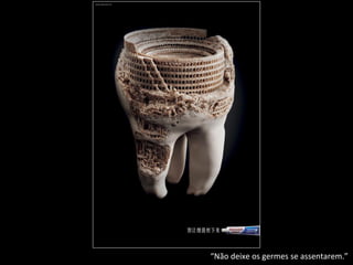 “Não deixe os germes se assentarem.”
 