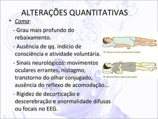 ALTERAÇÕES QUANTITATIVAS
• Coma:
  - Grau mais profundo do
   rebaixamento.
  - Ausência de qq. indício de
   consciência e atividade voluntária.
  - Sinais neurológicos: movimentos
   oculares errantes, nistagmo,
   transtorno do olhar conjugado,
   ausência do reflexo de acomodação...
  - Rigidez de decorticação e
   descerebração e anormalidade difusas
   ou focais no EEG.
 
