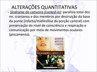 ALTERAÇÕES QUANTITATIVAS
- Síndrome do cativeiro (Locked-in): paralisia total dos
 nn. cranianos e dos membros por destruição da base
 da ponte (infarto/mielinólise da porção central) com
 preservação do nível de consciência e respiração e
 comunicação por meio de movimentos oculares
 (piscamento).
 