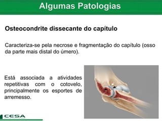 Osteocondrite dissecante do capítulo
Caracteriza-se pela necrose e fragmentação do capítulo (osso
da parte mais distal do úmero).
Está associada a atividades
repetitivas com o cotovelo,
principalmente os esportes de
arremesso.
 