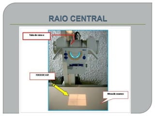 RADIOLOGIA CONVENCIONAL E FORMAÇÃO DOS RAIOS X