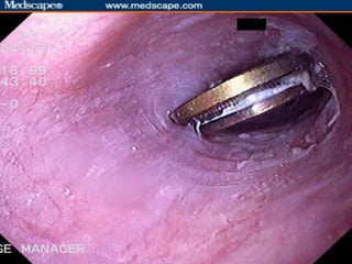 RADIOLOGIA CONVENCIONAL E FORMAÇÃO DOS RAIOS X