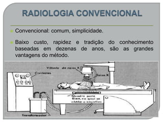  Convencional: comum, simplicidade.
 Baixo custo, rapidez e tradição do conhecimento
baseadas em dezenas de anos, são as grandes
vantagens do método.
 